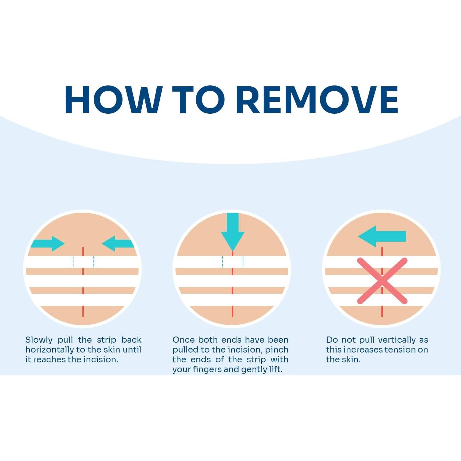 Cierre de Heridas Conkote - 40 Tiras Transpirables 15.6x8.0 cm