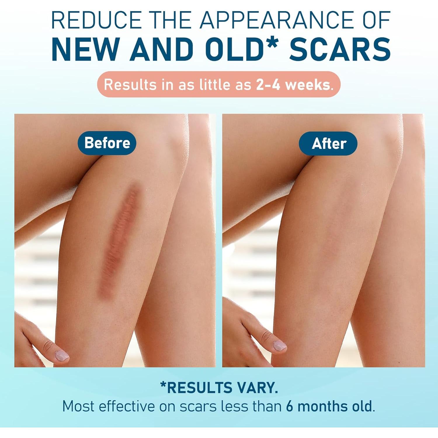 Hojas de Silicona para Cicatrices LotFancy - 10 Piezas 3.81x15.24cm