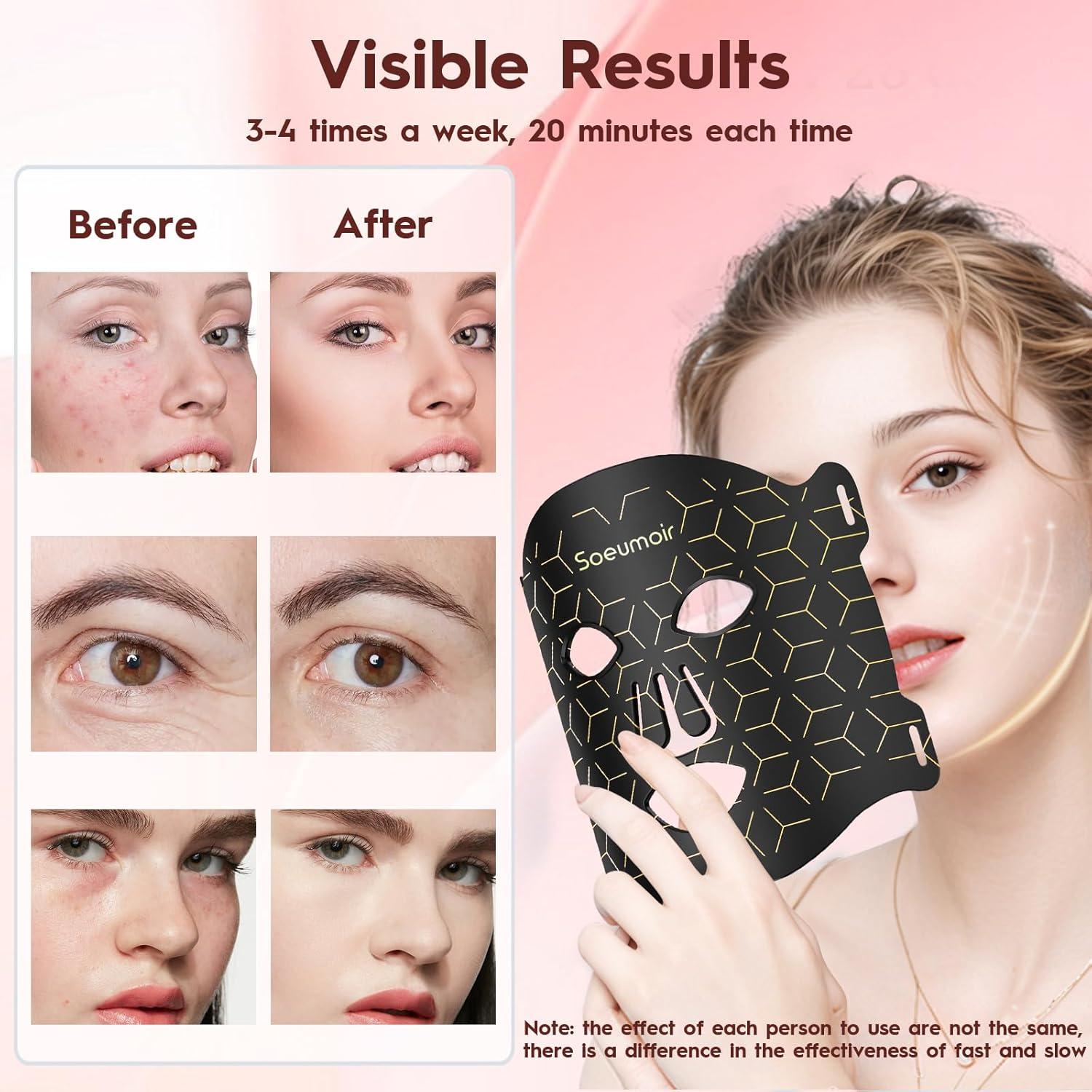 Máscara de Luz Roja LED Soeumoir con Control Remoto y 7 Modos