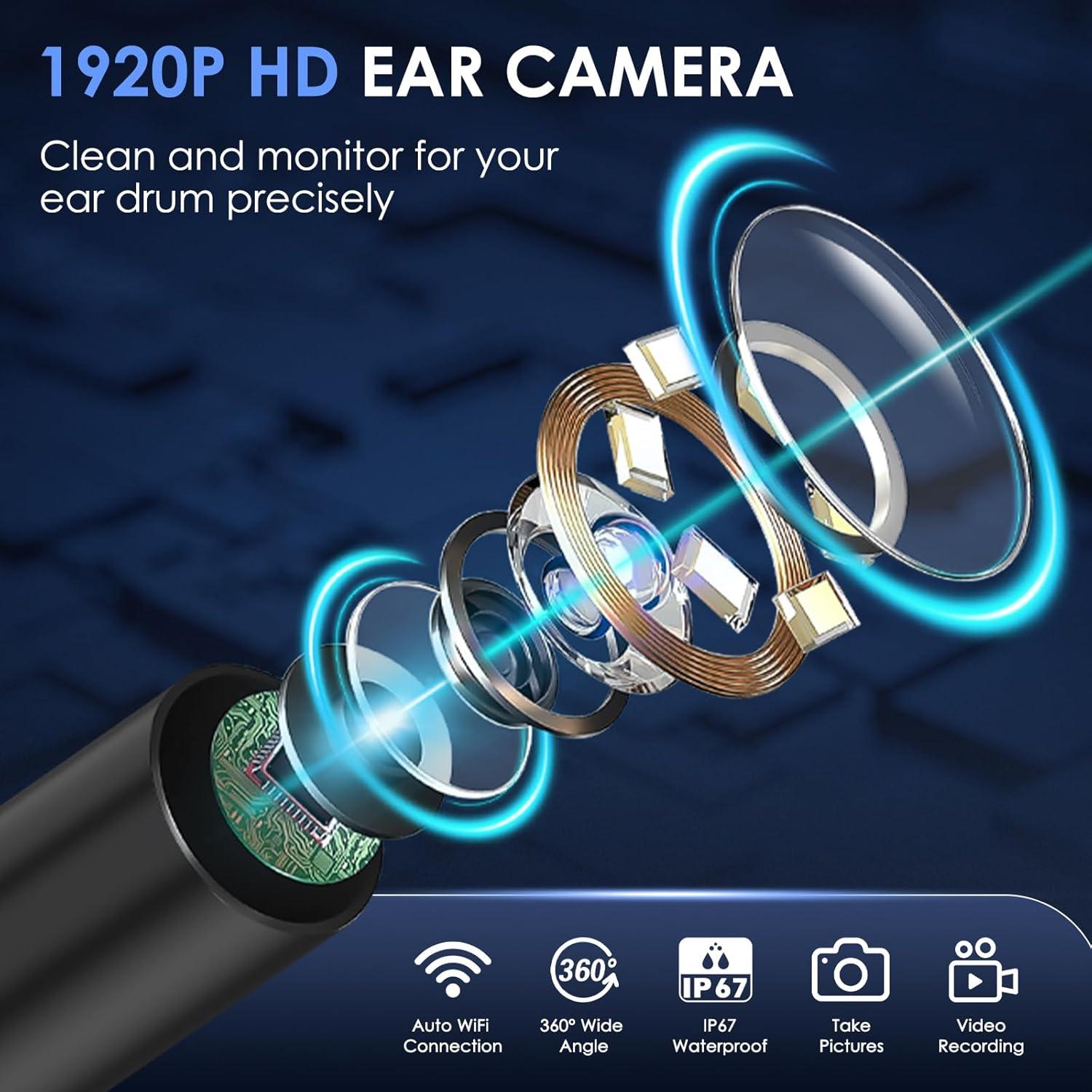 Kit de Eliminación de Cerumen Xylla con Cámara HD 1920P y 12 PZS