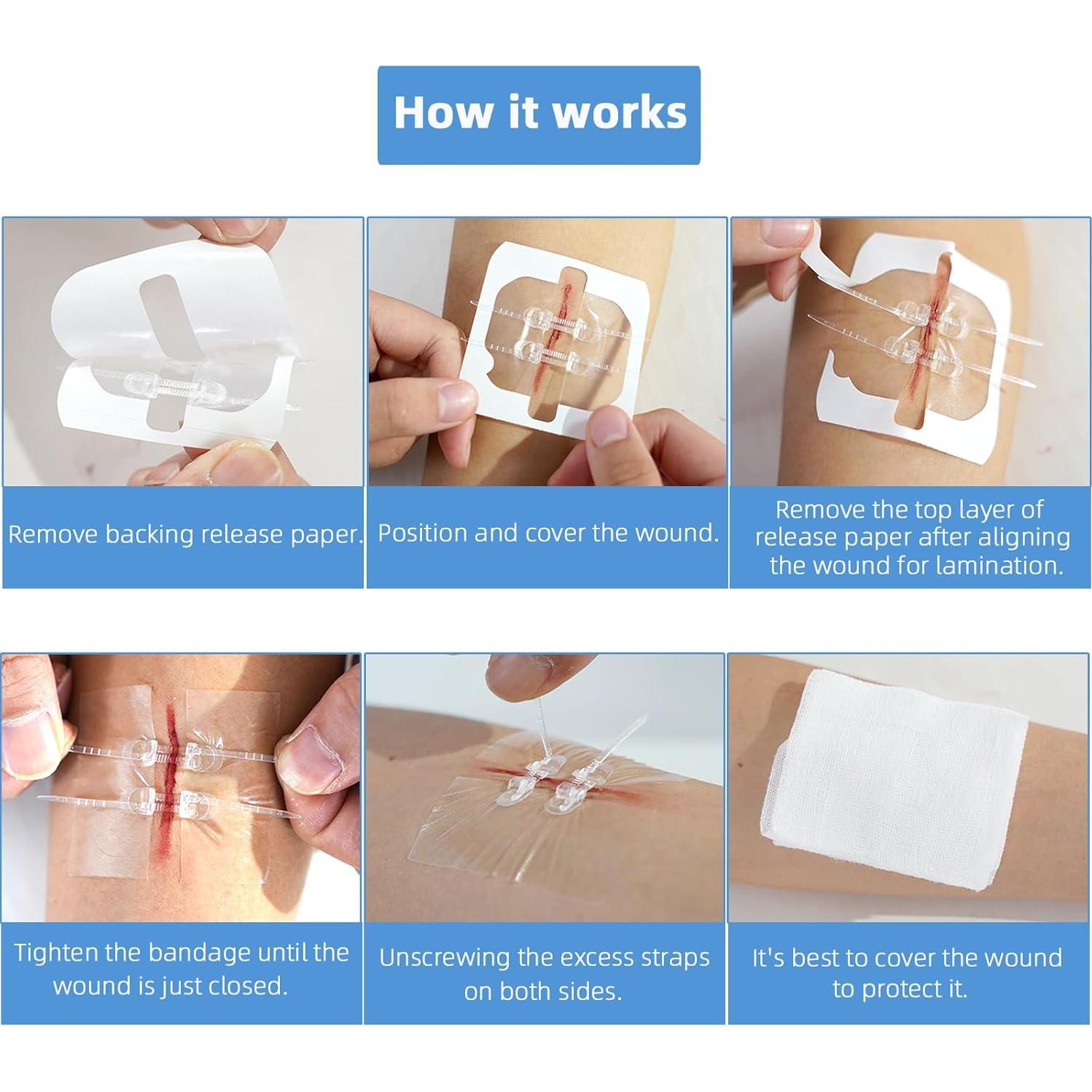 Kit de Cierre de Heridas Soknazq - 4 Tiras Adhesivas y Más