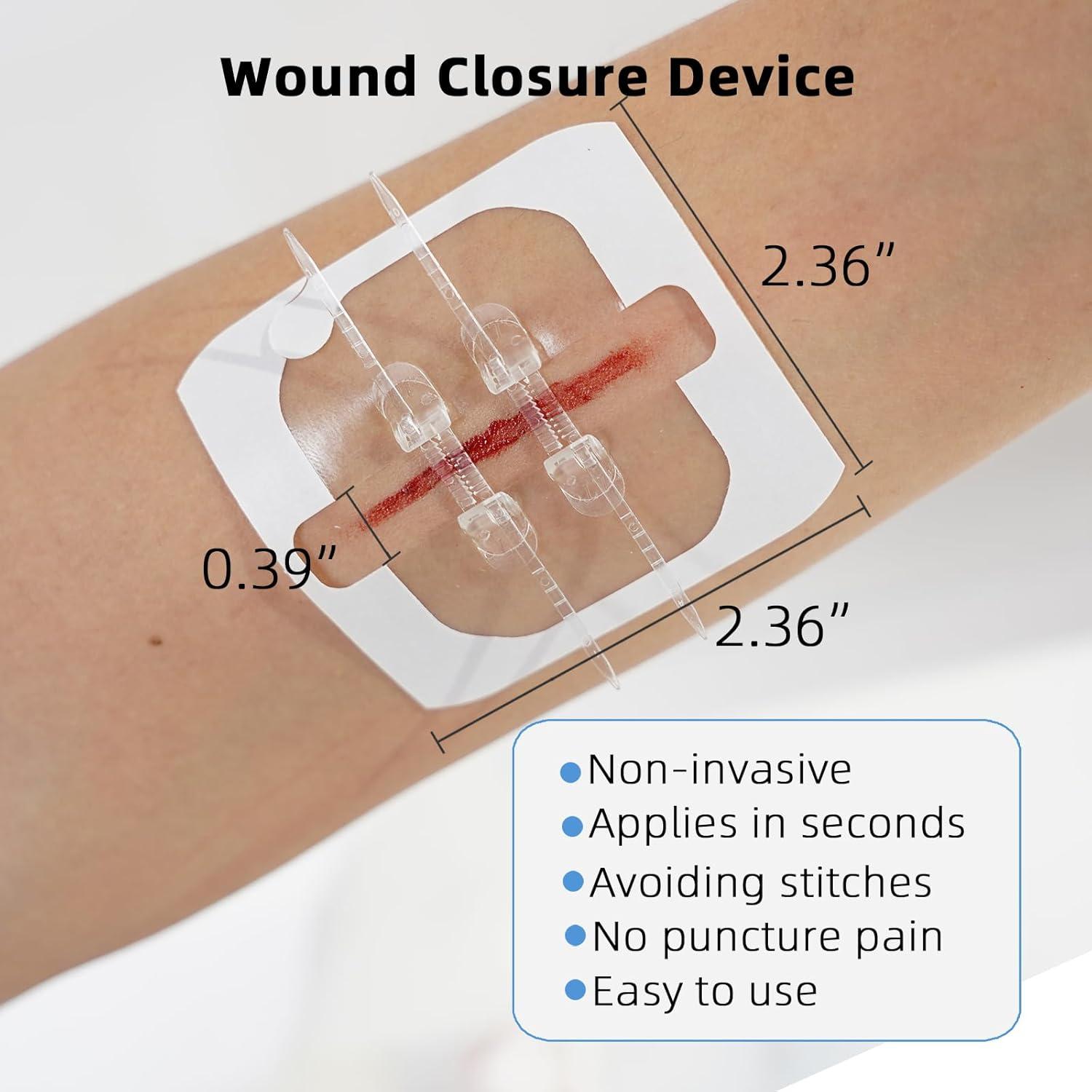 Kit de Cierre de Heridas Soknazq - 4 Tiras Adhesivas y Más