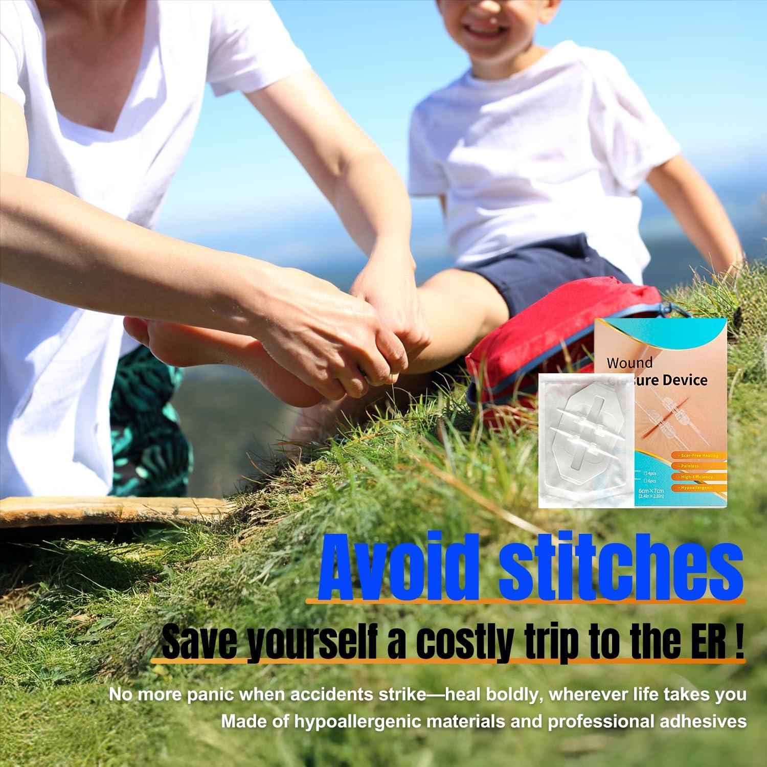 4 Vendajes Mariposa Hons para Cierre de Heridas Sin Suturas