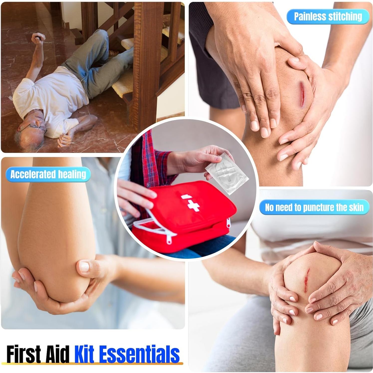 4 Vendajes Mariposa Hons para Cierre de Heridas Sin Suturas