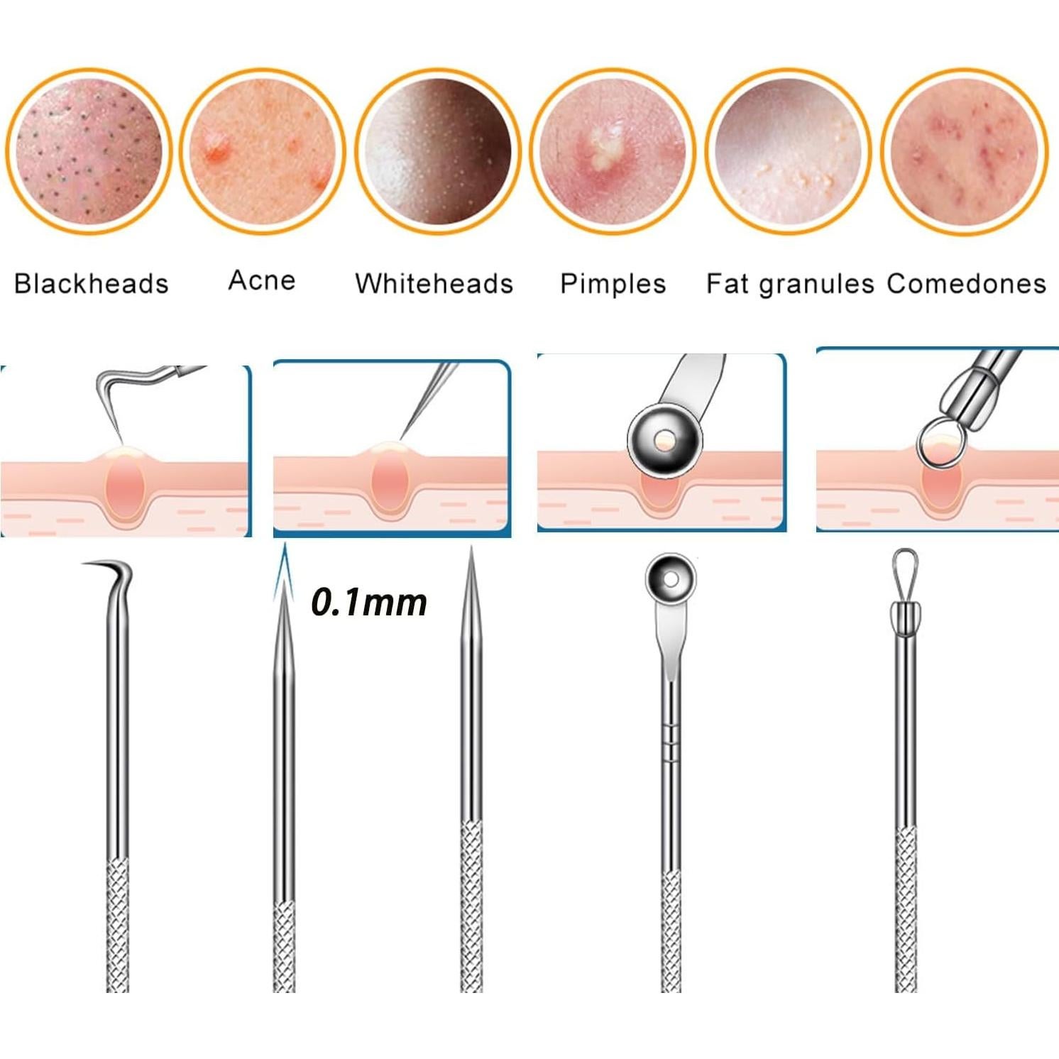 Kit de Pinzas para Puntos Negros Fecong - Acero Inoxidable 8PCS