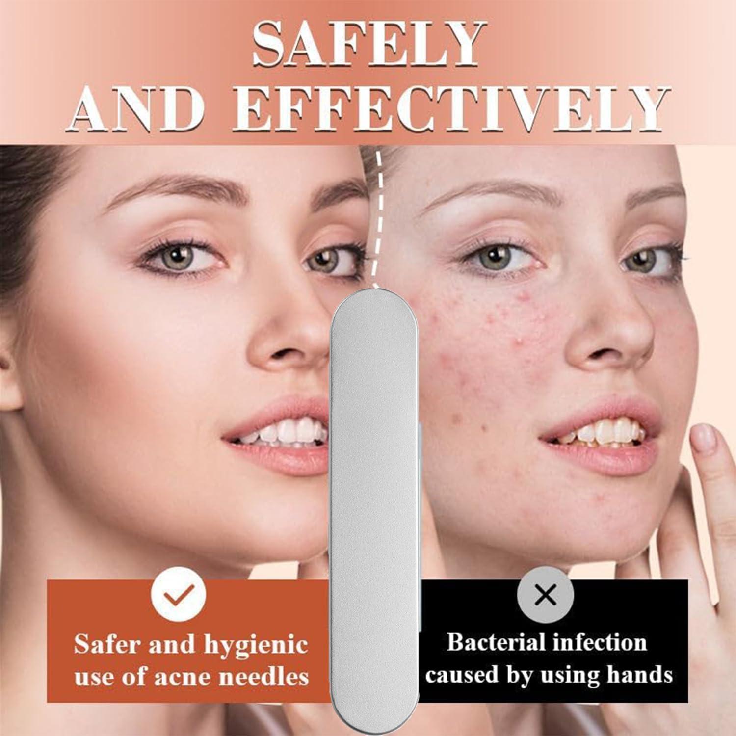 Kit de Pinzas para Puntos Negros Fecong - Acero Inoxidable 8PCS