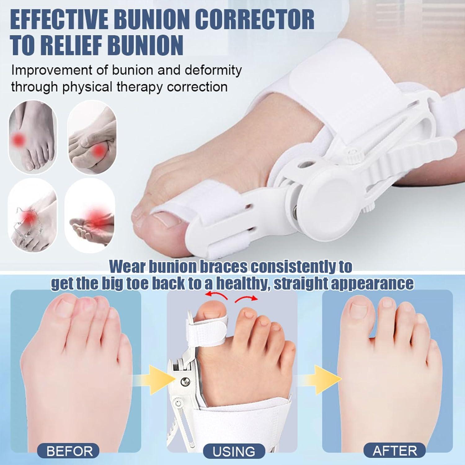 Corrector de Juanetes Fittakan Negro - Alivio Hallux Valgus