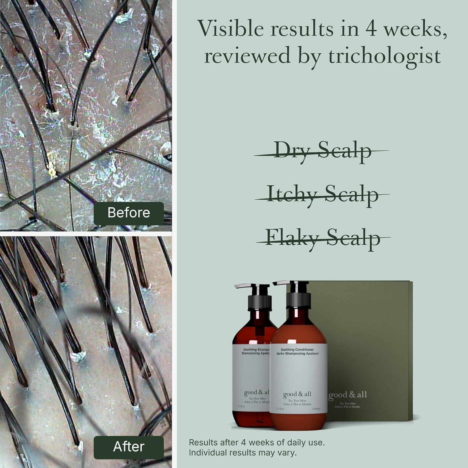 Juego de Champú y Acondicionador Good&All 400 ml - Árbol de Té