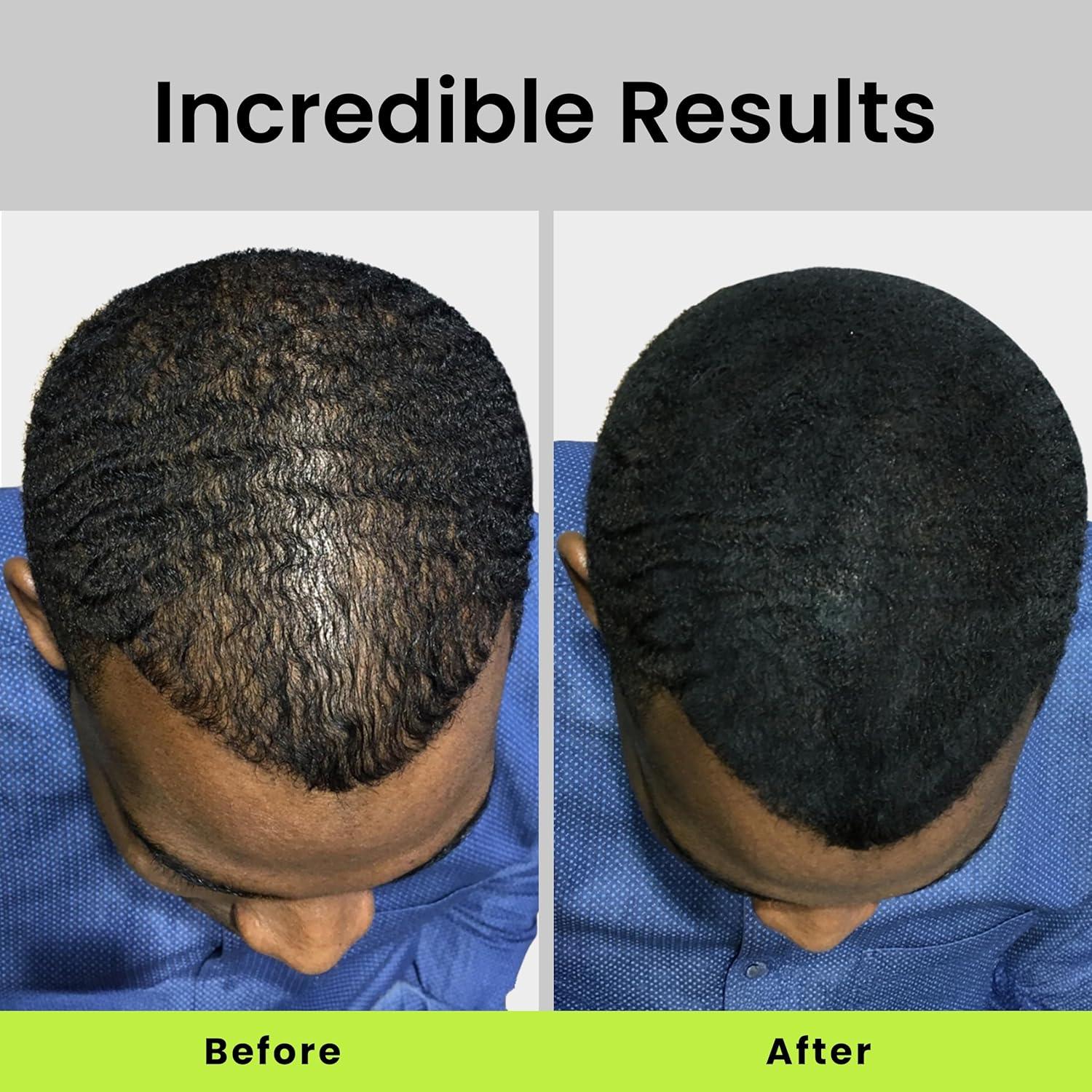 Fibras para Cabello ECLIPSE Castaño 15g - Oculta Pérdida Rápido