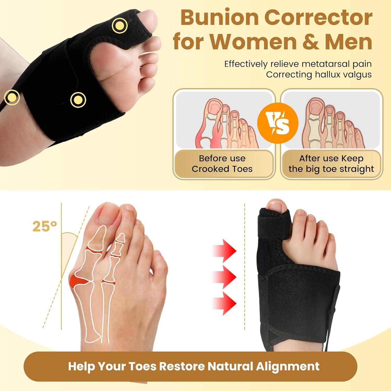 Corrector de Juanetes CEYOME - Férula Ajustable con Almohadillas