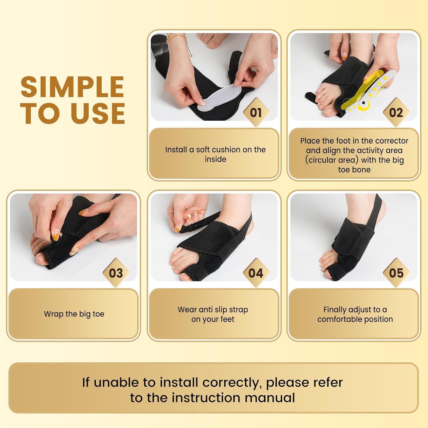 Corrector de Juanetes CEYOME - Férula Ajustable con Almohadillas