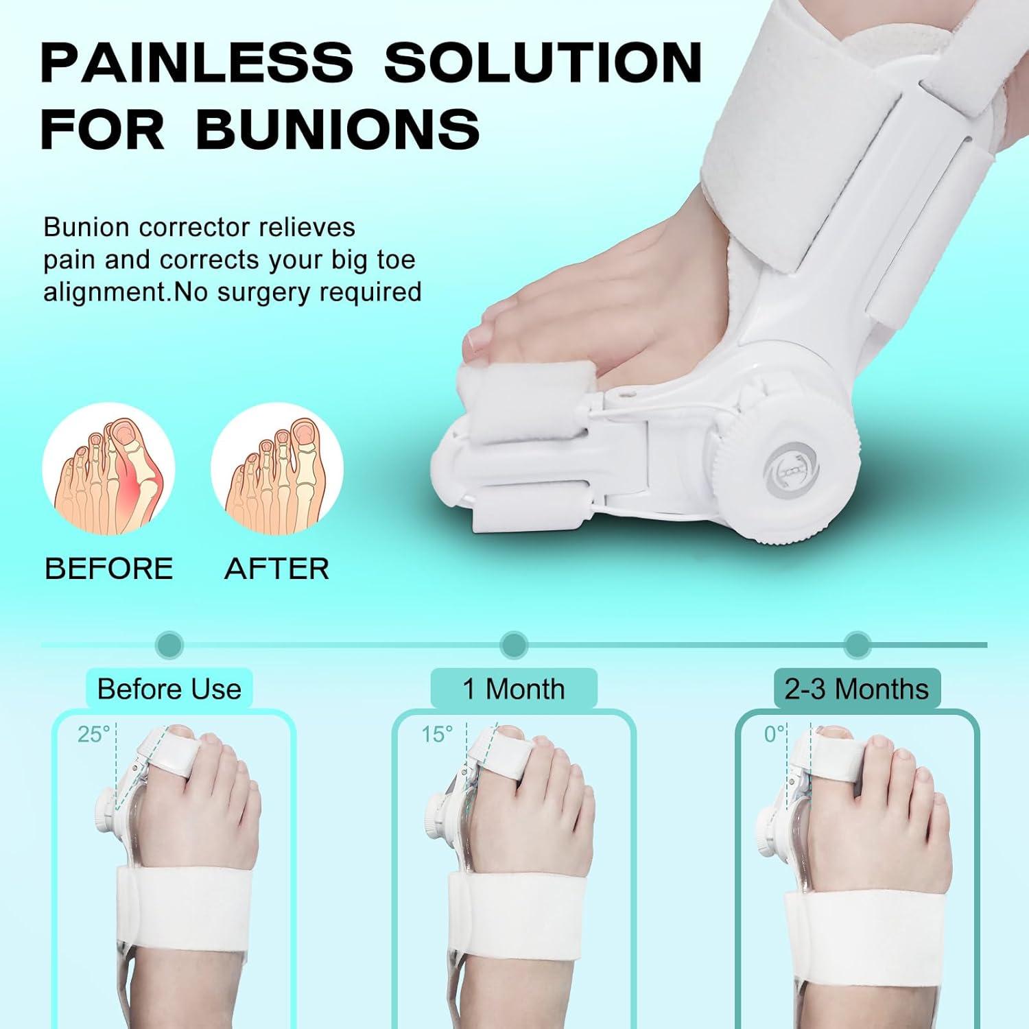 Corrector de Juanetes MentHiker Ajustable Unisex - Alivio Dolor