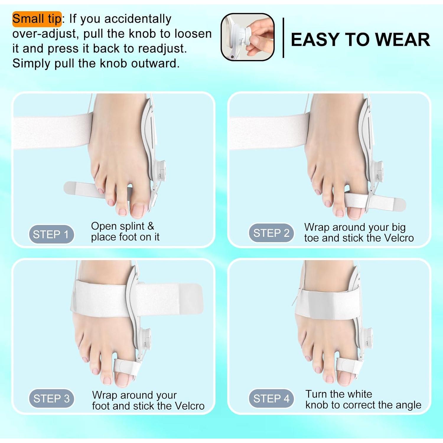 Corrector de Juanetes MentHiker Ajustable Unisex - Alivio Dolor