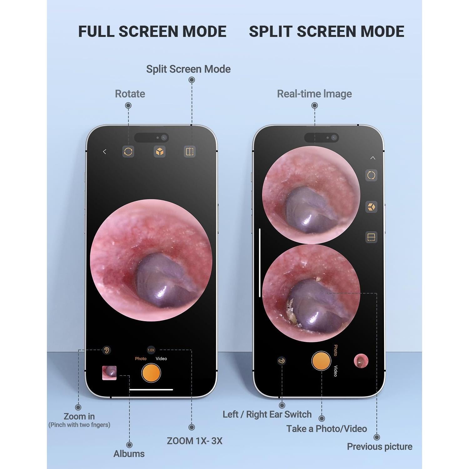 Otoscopio Digital AnyScope HD para iPhone y Android - Remoción de Cerumen