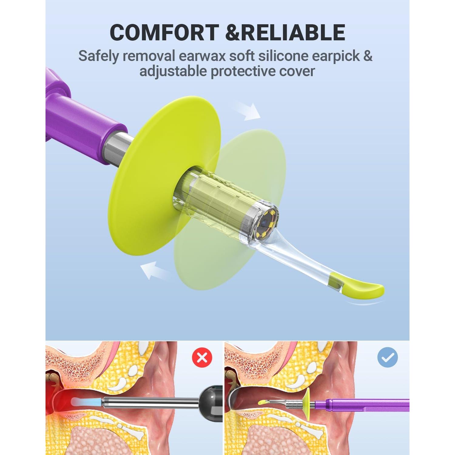 Otoscopio Digital AnyScope HD para iPhone y Android - Remoción de Cerumen