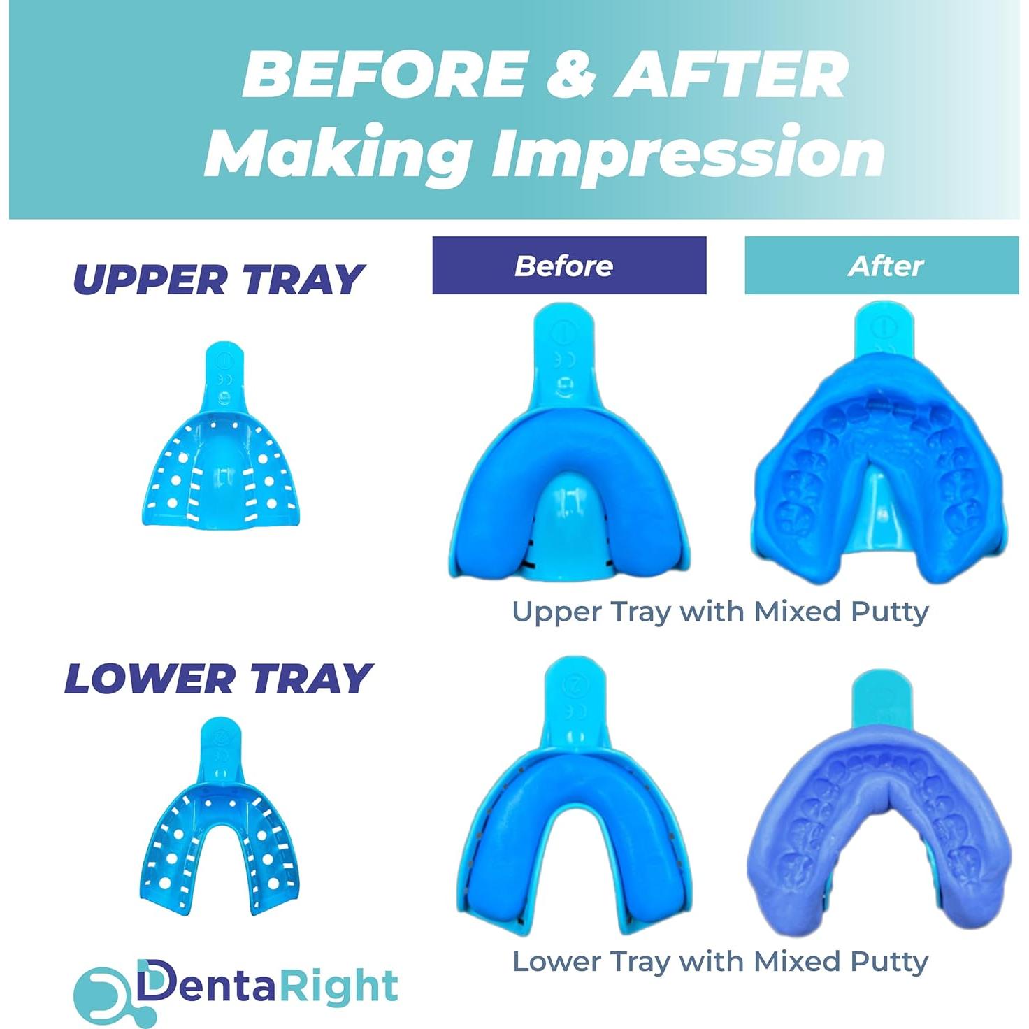 Kit de Férula Dental Personalizada DentaRight - Bruxismo