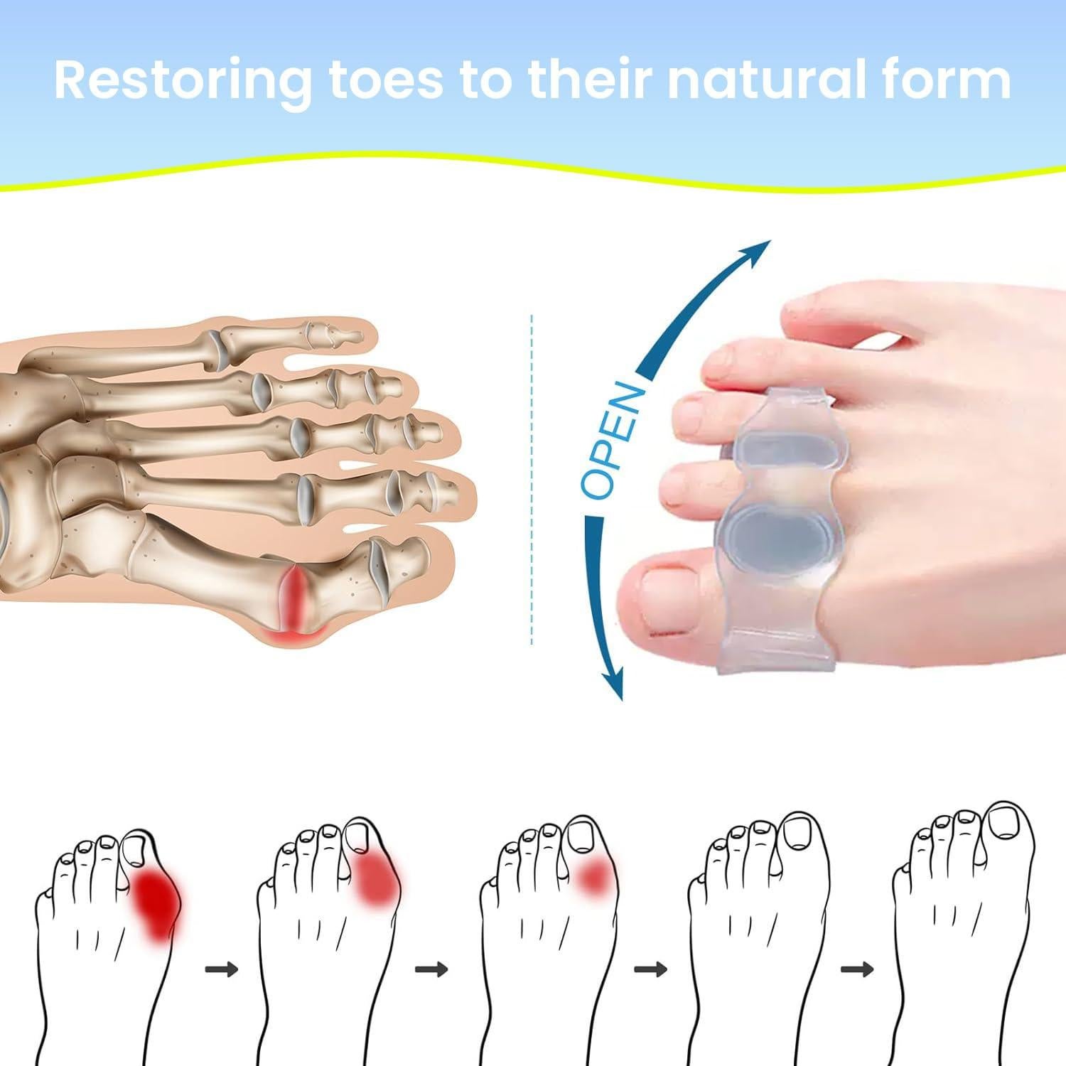 Corrector de Juanetes Ajustable XREKNOi Modelo 02 para Alivio