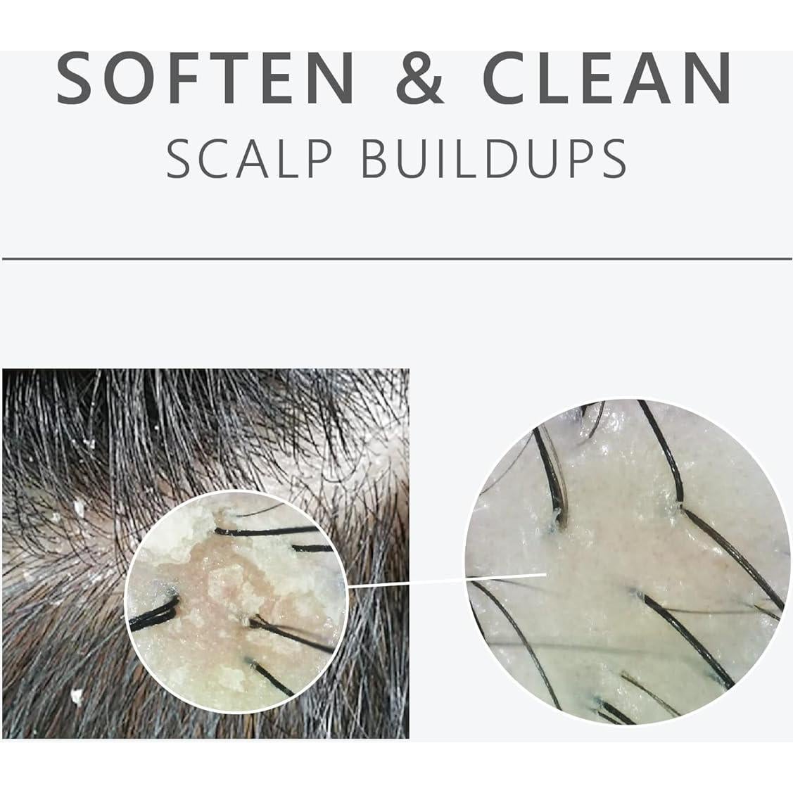 Champú Purificante AROMASE 5α Juniper 260 ml - Anti-caspa