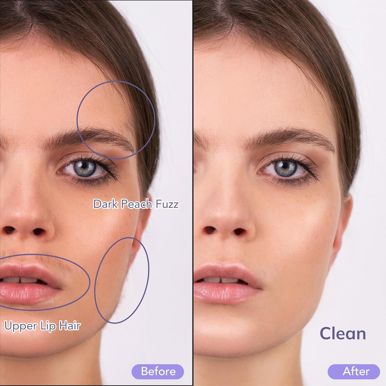 Herramienta Eléctrica Dermaplaning PELCAS 2 en 1 con Luz LED