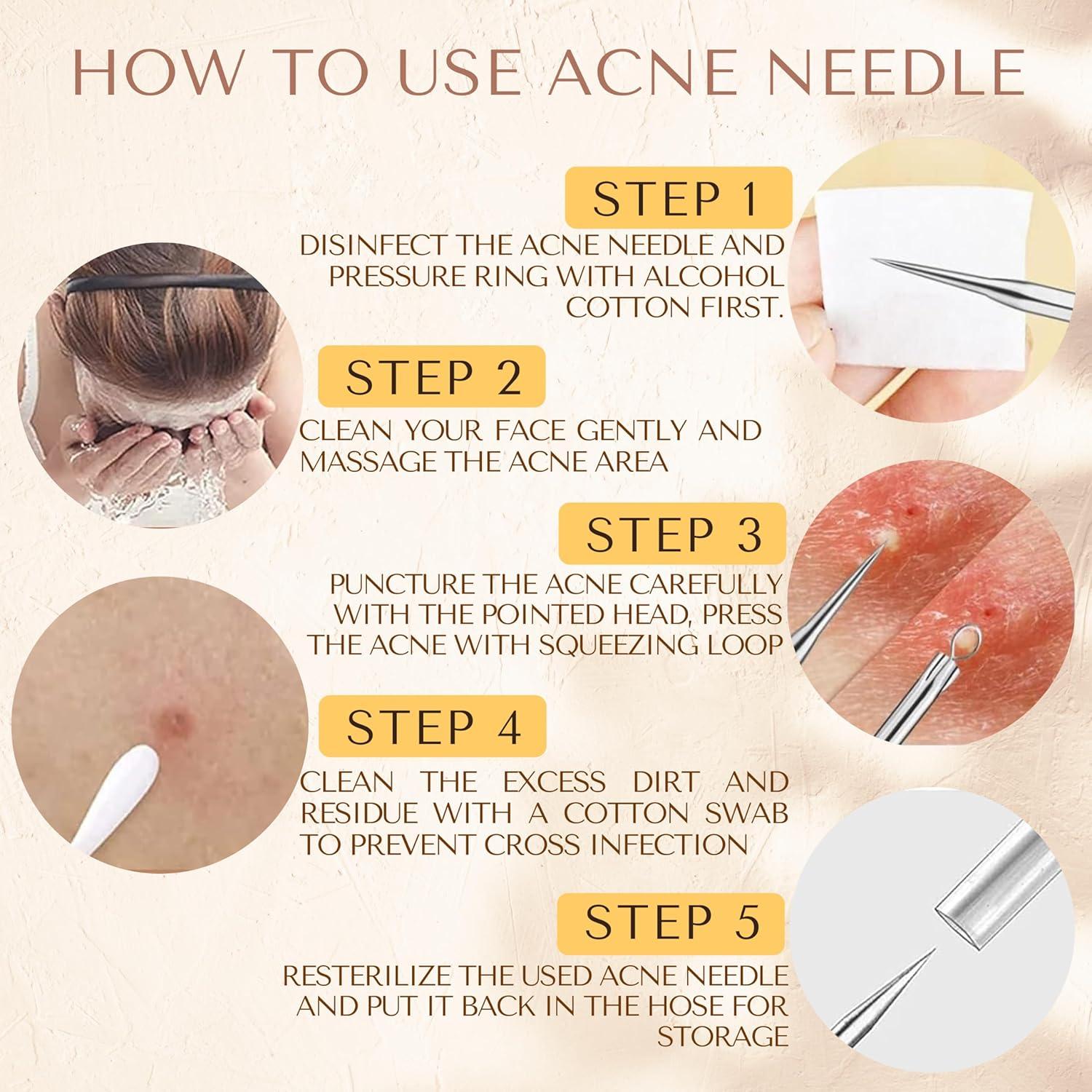 Kit de Herramientas para Eliminar Puntos Negros Dermated 16 Piezas