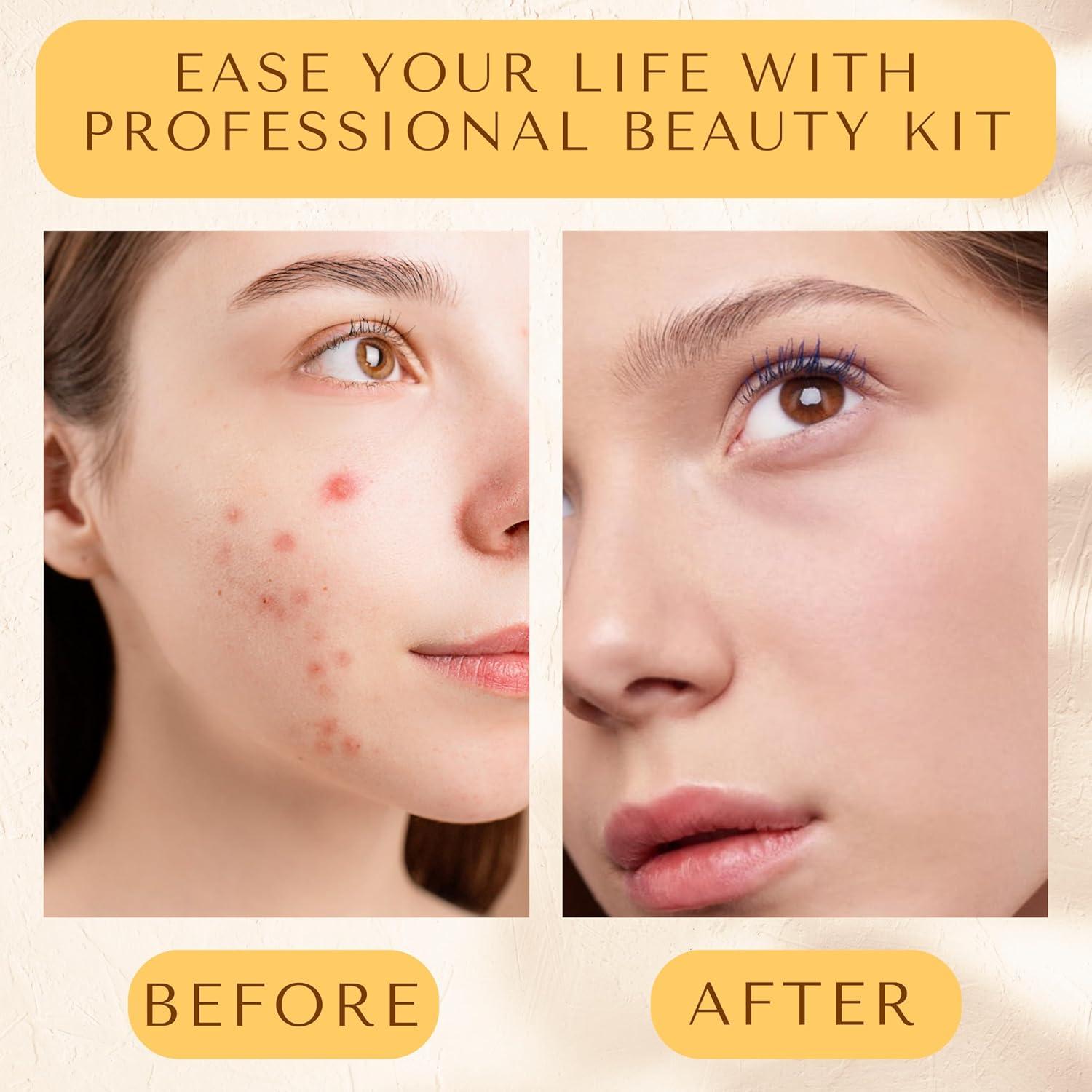 Kit de Herramientas para Eliminar Puntos Negros Dermated 16 Piezas