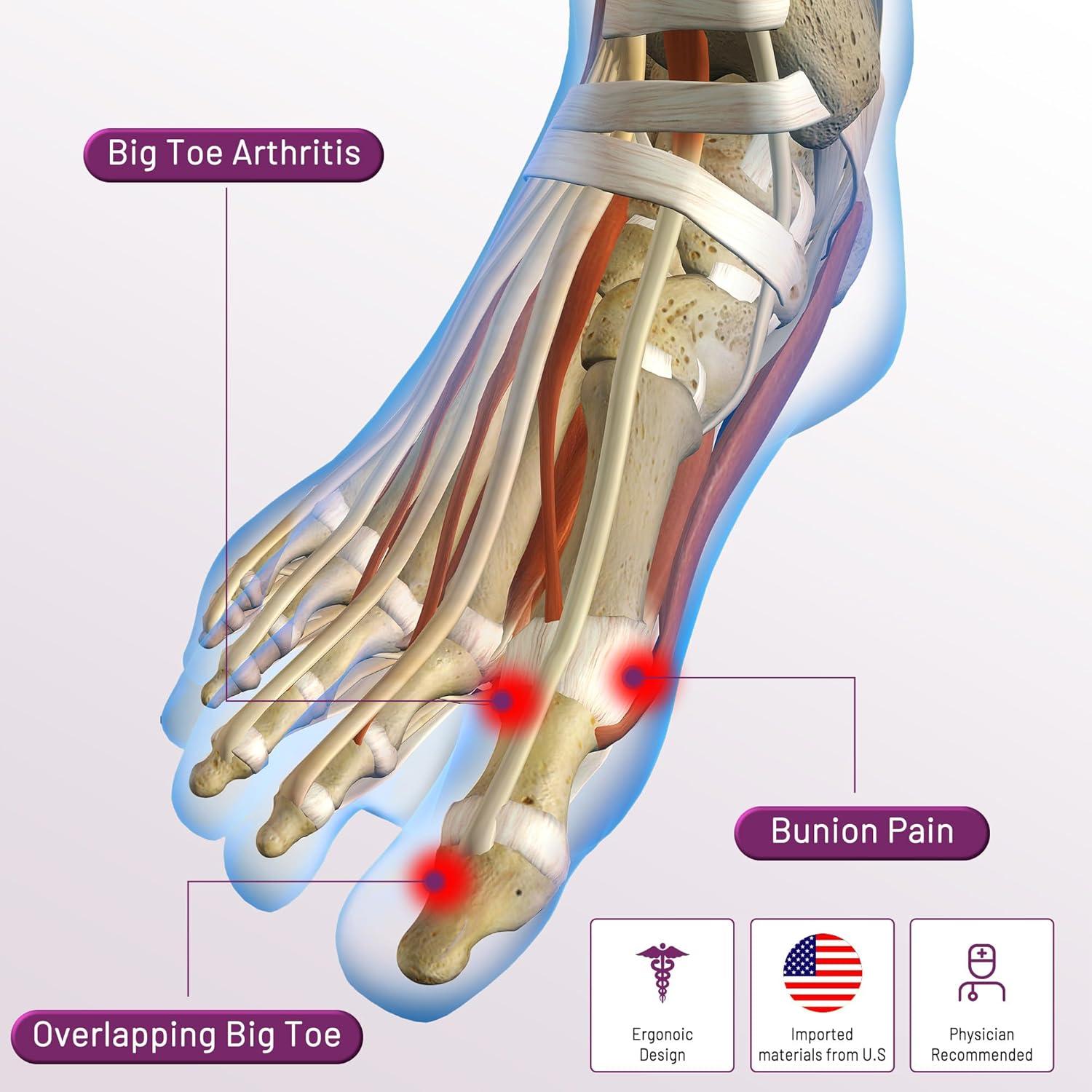 Manga Correctora de Juanetes LEOWEER - 4 Tamaños, Gel y Transpirable