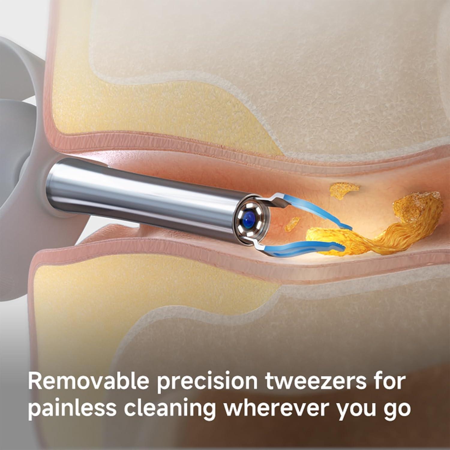 Limpiador de Oídos Inalámbrico YZLCZ con Cámara HD 1080P