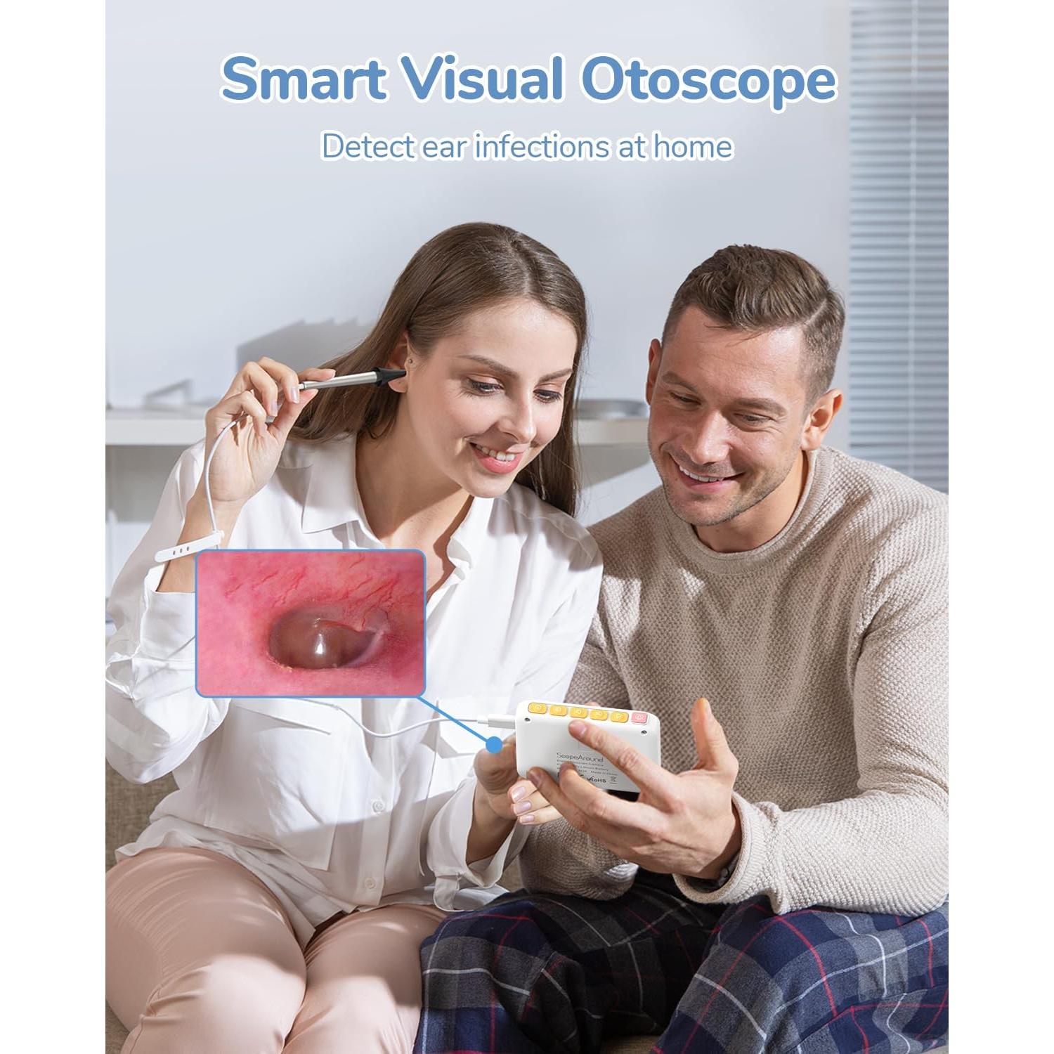 Otoscopio Digital ScopeAround HD 720P con Luz - 3.9mm