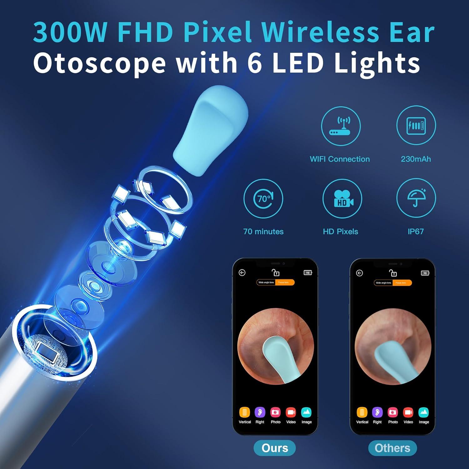 Limpiador de Oído Inalámbrico Goropo con Cámara HD y 4 Puntas