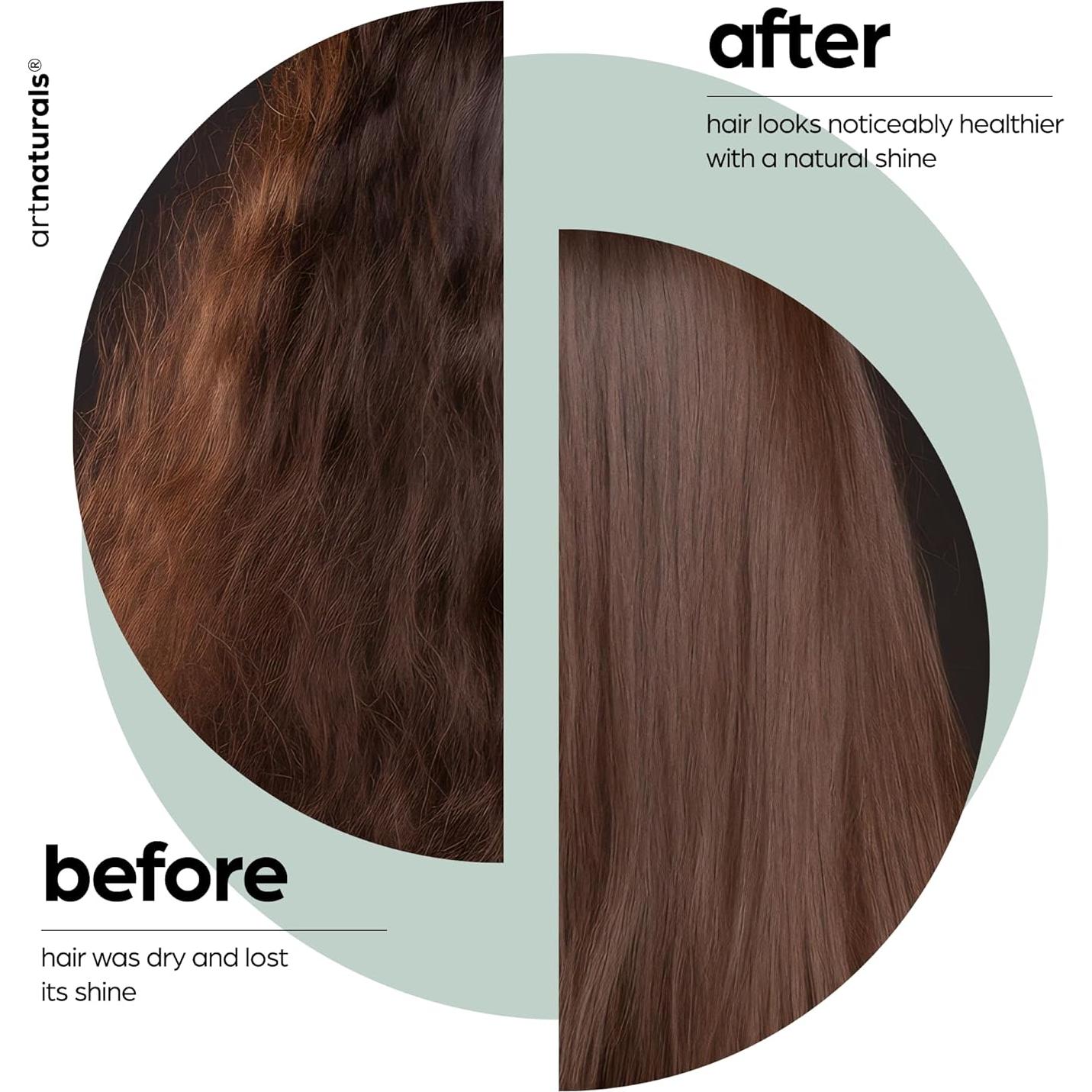 Acondicionador Artnaturals 473ml - Aceite de Árbol de Té - Anti Caspa