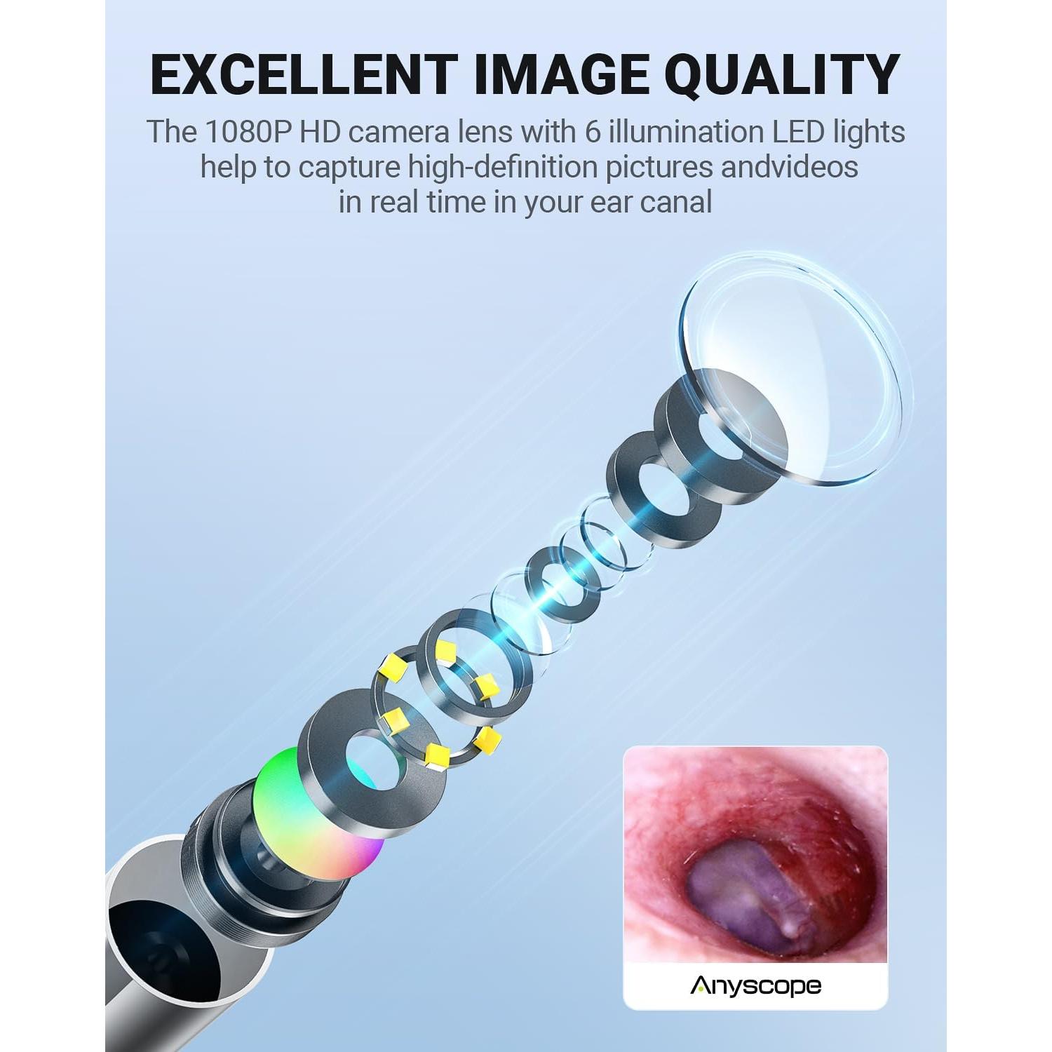 Otoscopio Digital AnyScope ASAKE100i HD con Luz y Giroscopio