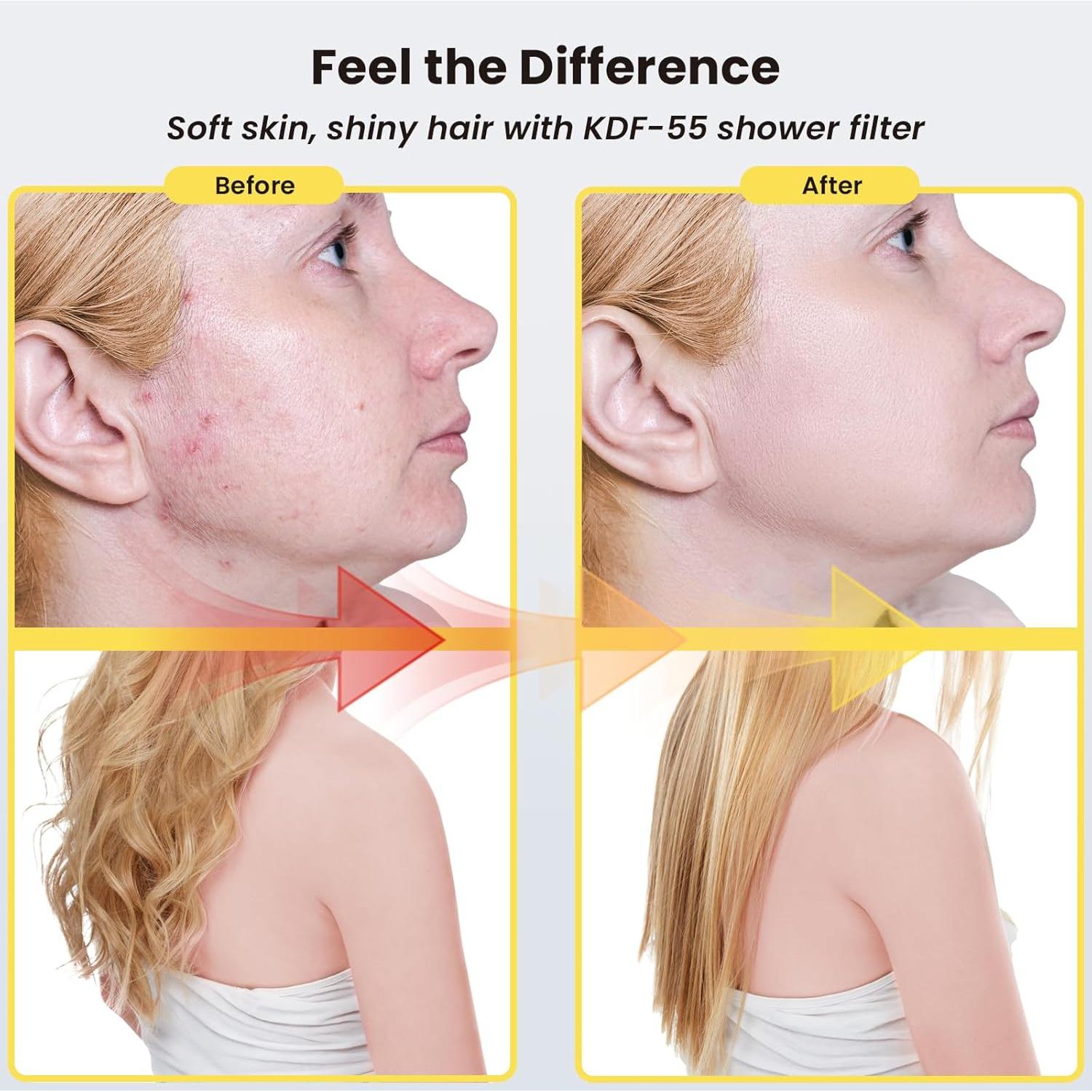 Cabezal de Ducha Filtrado Ryamen de Alta Presión 1.25kg