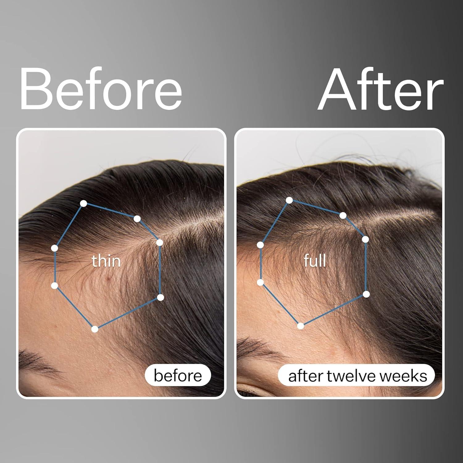 Suero de Células Madre Act+Acre 29.57 ml - Hidrata y Nutre Cabello