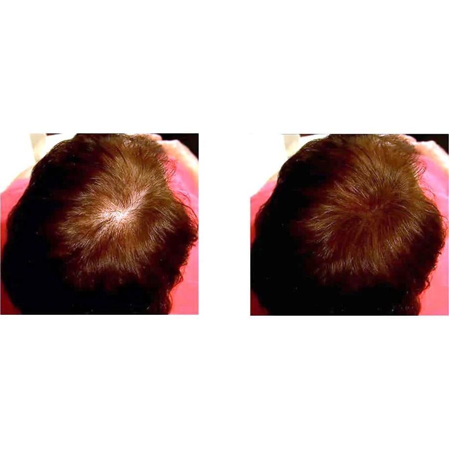 Fibra de Cabello Natural Caboki 3x30g Castaño - Suministro 270 Días