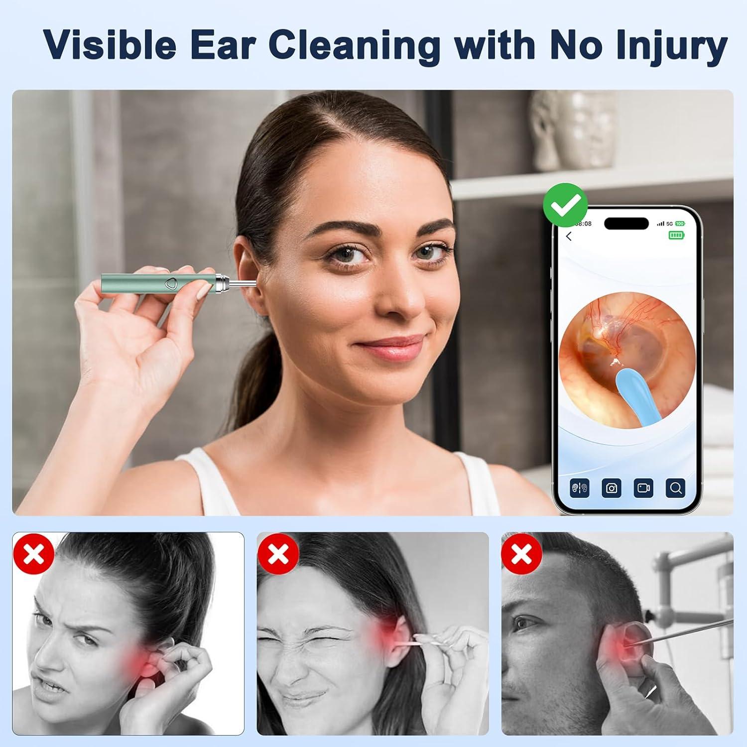 Limpiador de Oídos Coolfor con Cámara 1080P y 6 LED Verde