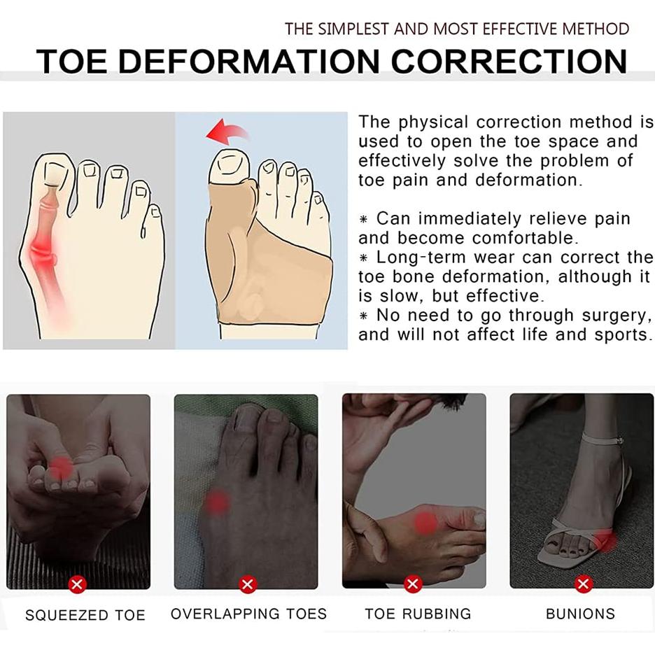 Mangas Separadoras de Dedos Xemz - 2 Pares Suaves y Transpirables