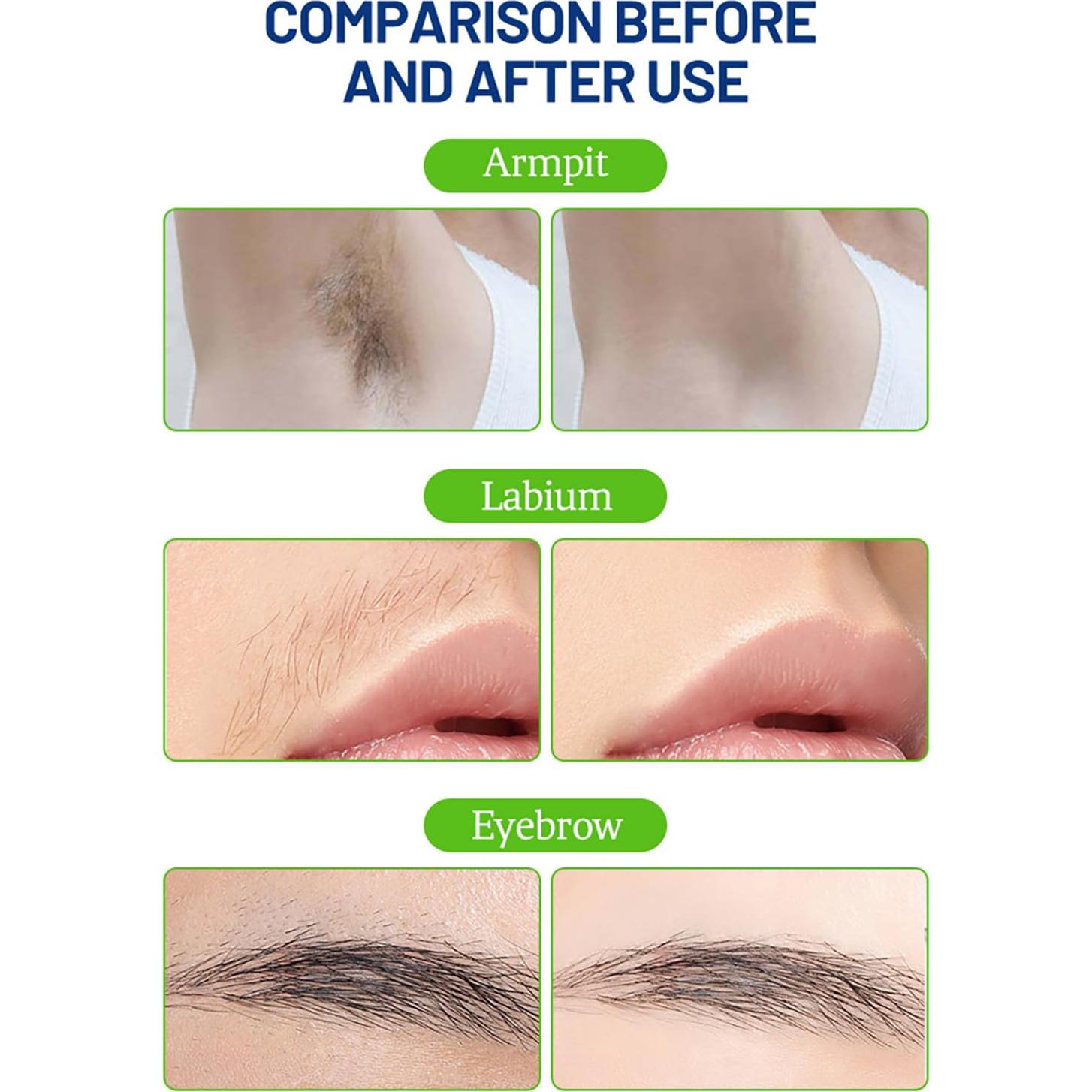 Cinta de Cera para Depilación Livepro 20PCS Piel Seca