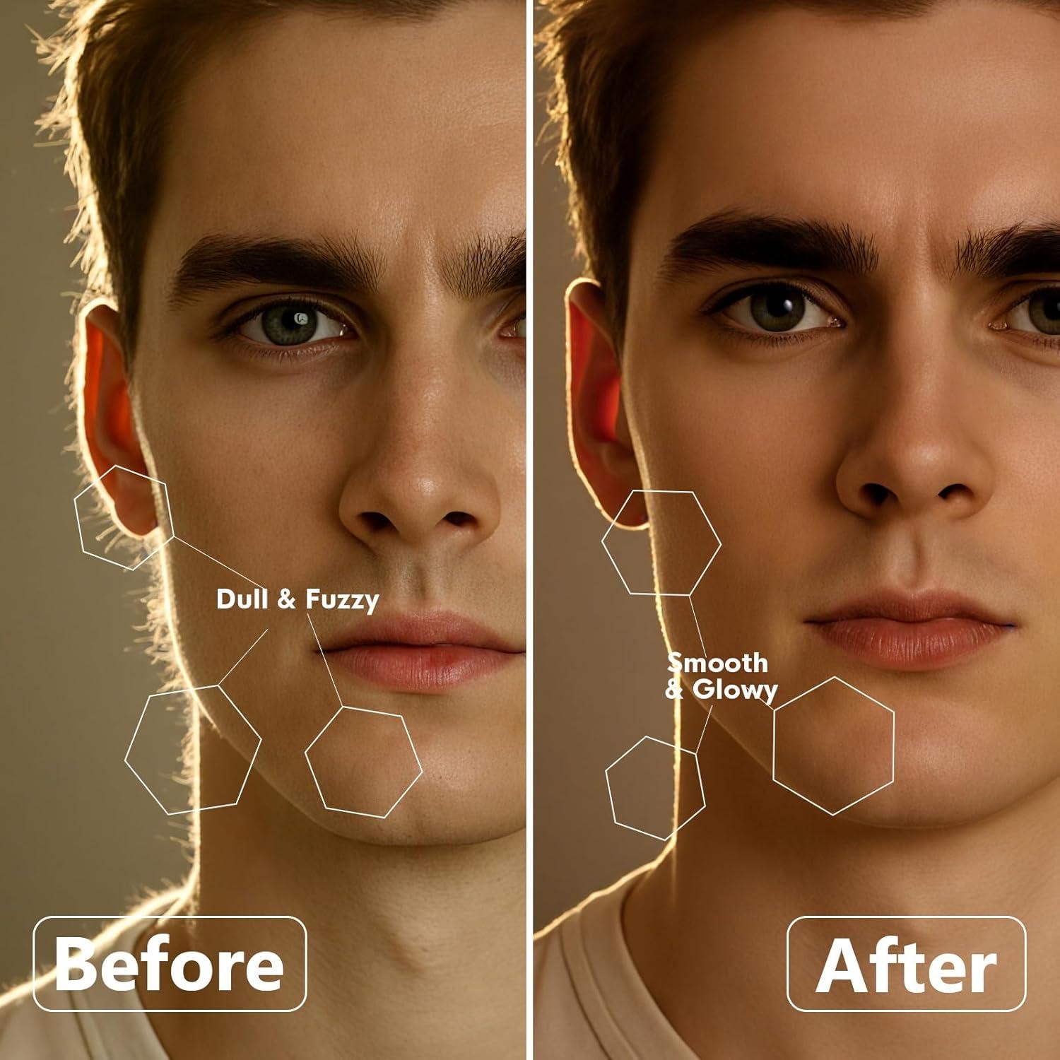 Razor Dermaplane Sonic Skinharbor - Exfoliación Facial 3 Velocidades