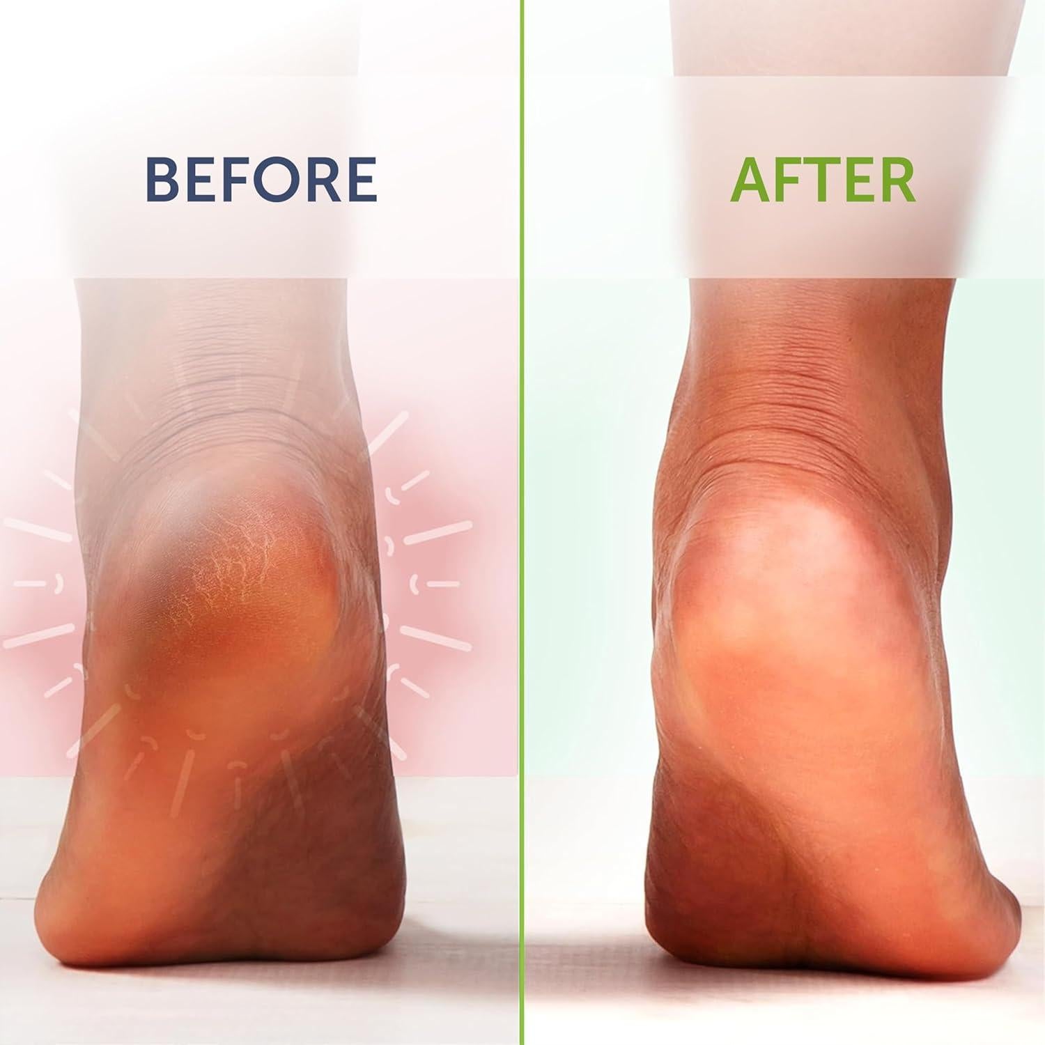 Baño de Pies 396g TruRemedy con Sal de Epsom y Aceite de Árbol de Té