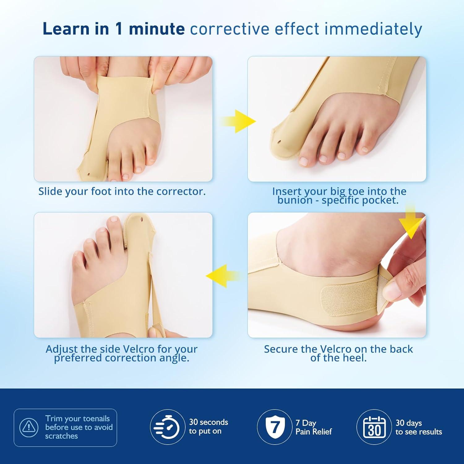 Corrector de Juanetes RUSHFORWARD Ajustable Unisex - Alivio Hallux Valgus