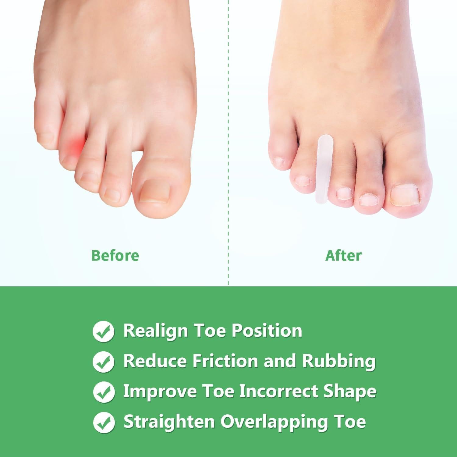 Separador de Dedos Mediano Niupiour - Alivio Juanetes, 10 Piezas