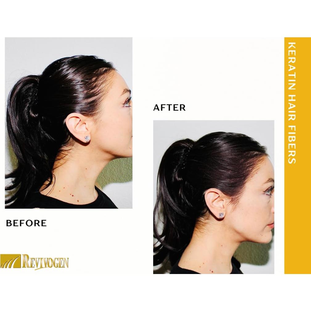 Fibras de Cabello de Queratina Revivogen MD 25.5g Negro