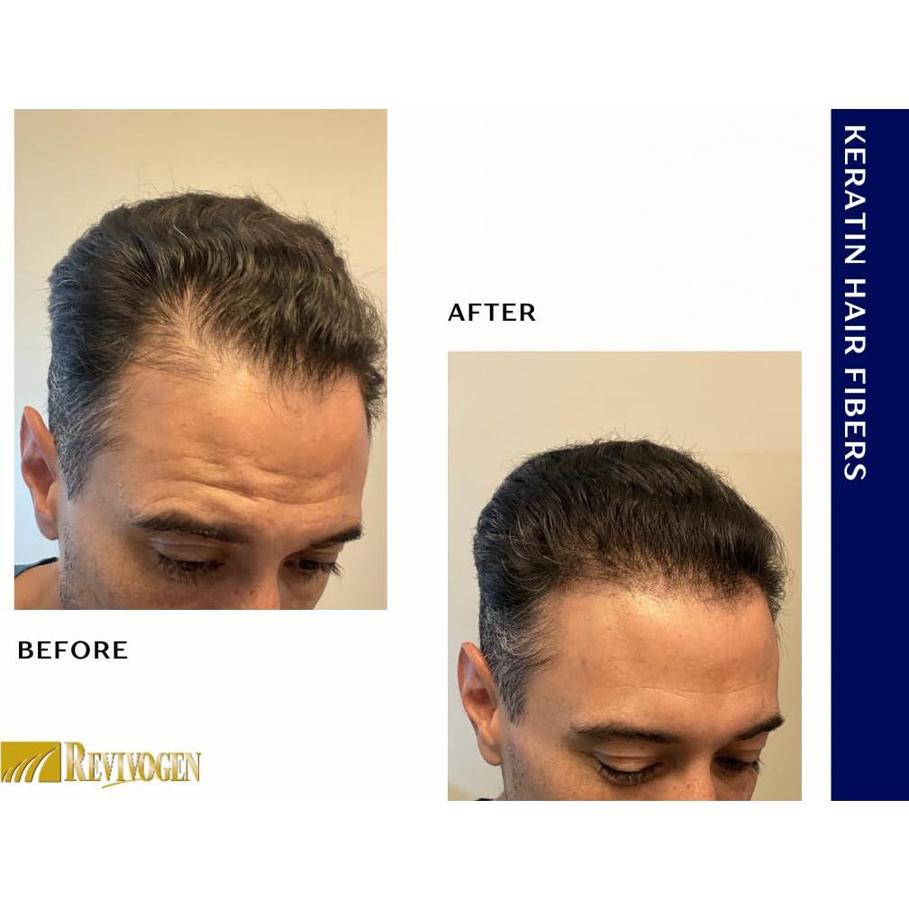 Fibras de Cabello de Queratina Revivogen MD 25.5g Negro