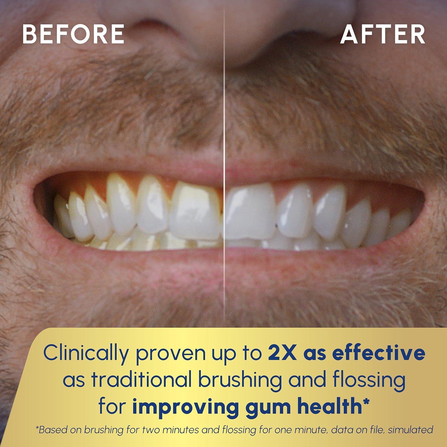 Cepillo de dientes eléctrico Waterpik Sonic-Fusion 2.0 Blanco