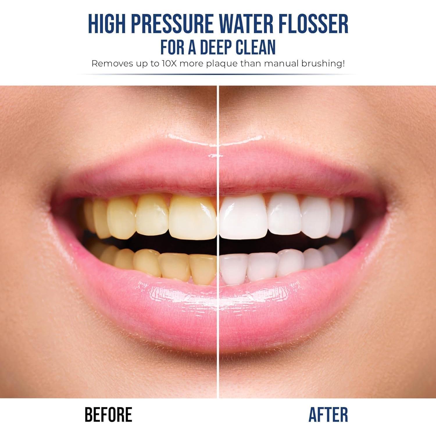 Cepillo de dientes eléctrico 2 en 1 Synergy Brands - Hilo dental y 40k vibraciones