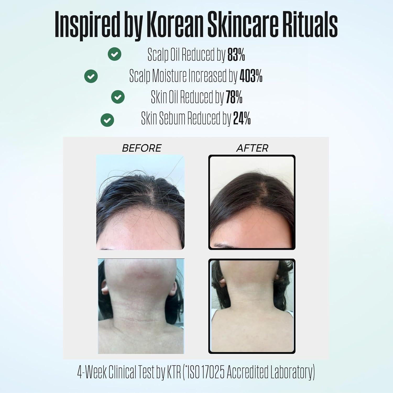 Cabezal de Ducha Filtrado Poseion BT100 - Alta Presión, 24.13 cm