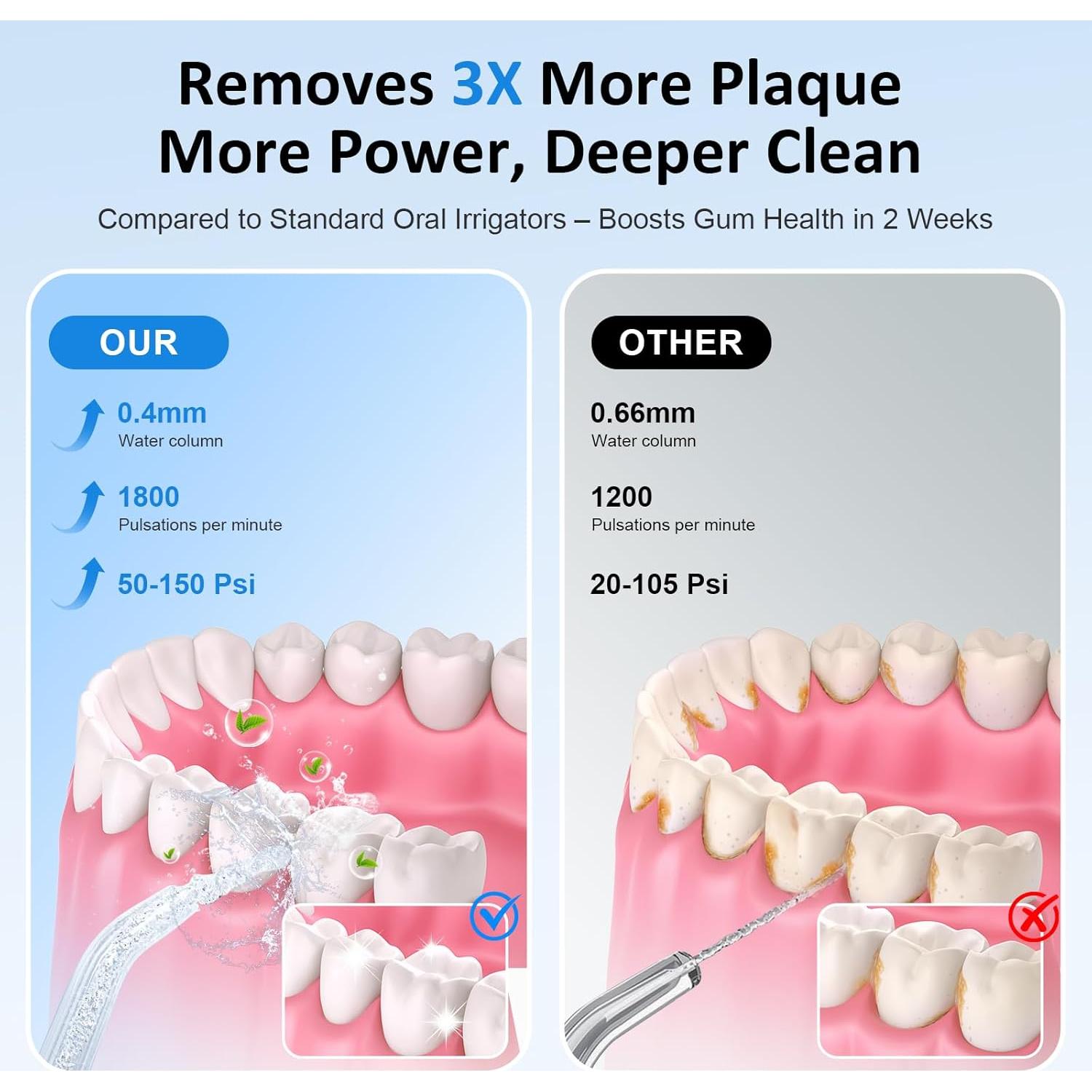 Irrigador Dental Inalámbrico Srivdk 300ML 3 Modos IPX7