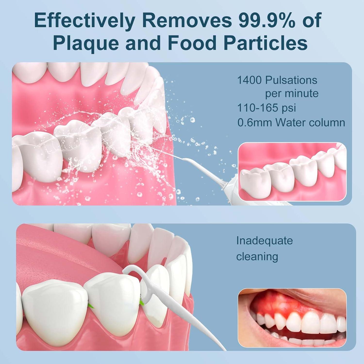 Irrigador Dental Inalámbrico Froomer OMD01 300ml 5 Modos IPX7