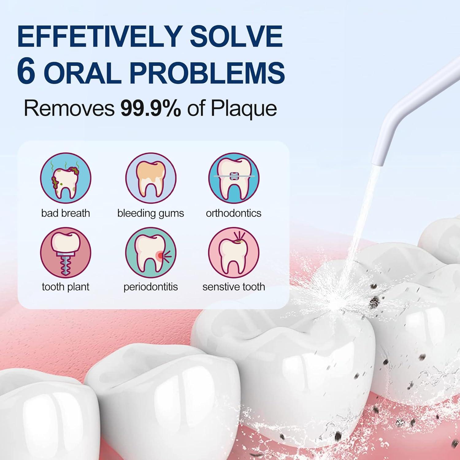 Irrigador Oral MOCEL WF02 Portátil 300ML 5 Modos USB C Blanco