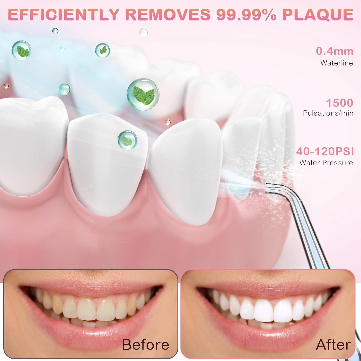 Irrigador Oral Portátil KOOVON Azul, IPX7, 5 Puntas, 4 Modos